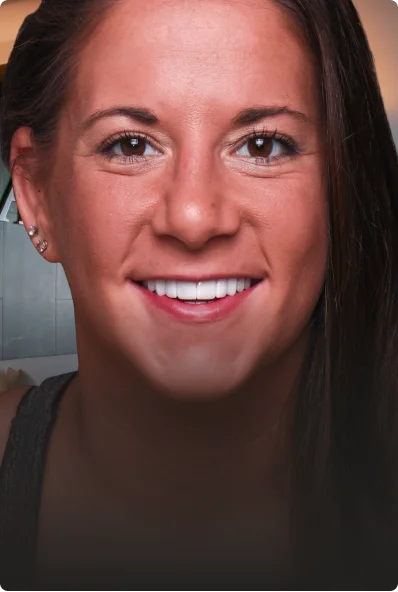 restored smile of a lady width dental crowns.